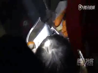 2 yo girl arm stuck in meat grounder