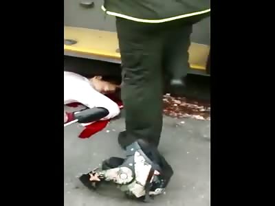 Aftermath Unlucky rider falls under bus and gets head crushed 