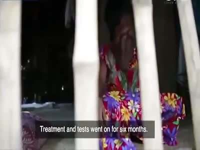 Girl left without a face by rare condition has no eyes or nose - and surgery could kill Her.