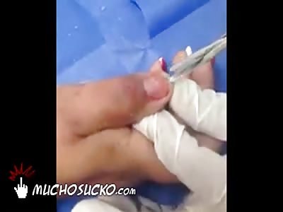 Told you to be careful.