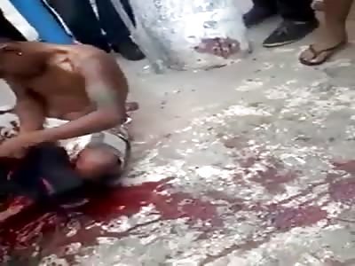 Young thug shot in the leg.