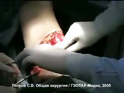 so you cut your leg when you have diabetes