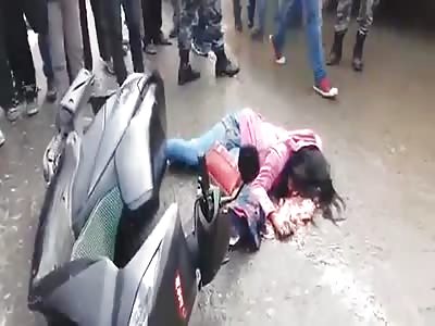 Brutal scooter aftermath