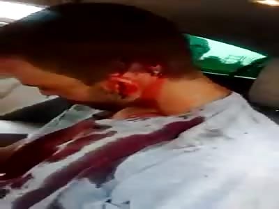 Bandit Dead With Bullet Shot Wounds to the Head after a Shootout with Police