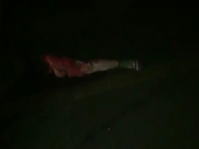 Woman's Body Looks Like Minced Meat After Brutal Accident