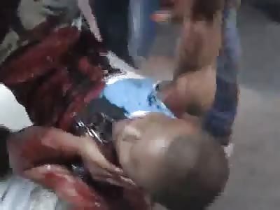 Man Arrives at the Hospital with a Stab in the Ortho Vein After a Fight