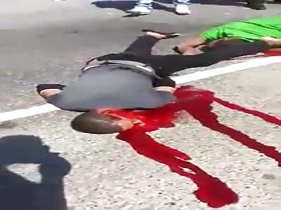 Dude's Face Crushed and Splattered in Blood. Bike is on Fire